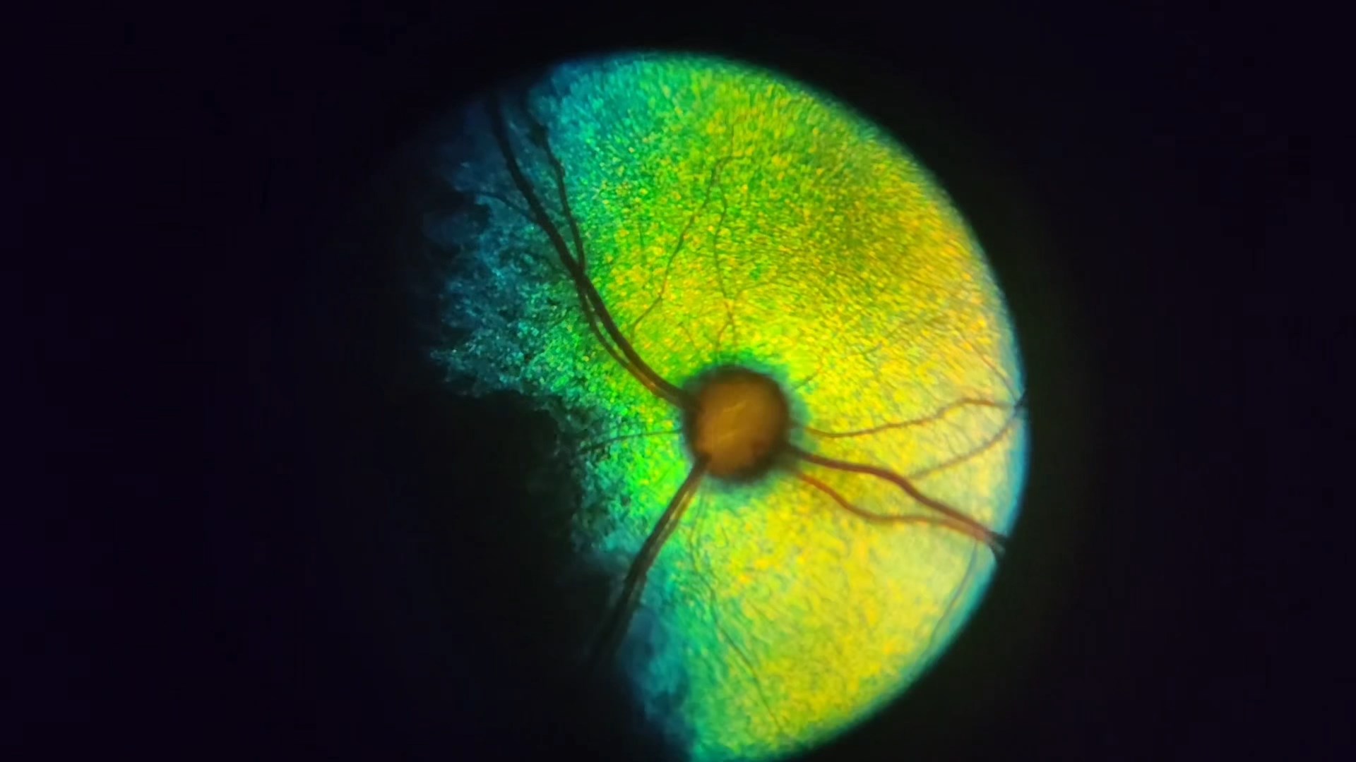 Портативный офтальмоскоп oDocs nun | Пример визуализации