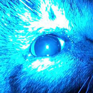 Отсутствие сужения зрачка на синий свет при колобоме зрительного нерва