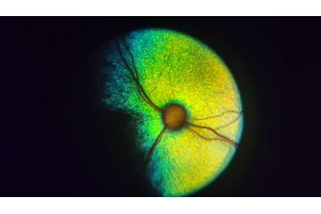 Портативный офтальмоскоп oDocs nun | Пример визуализации