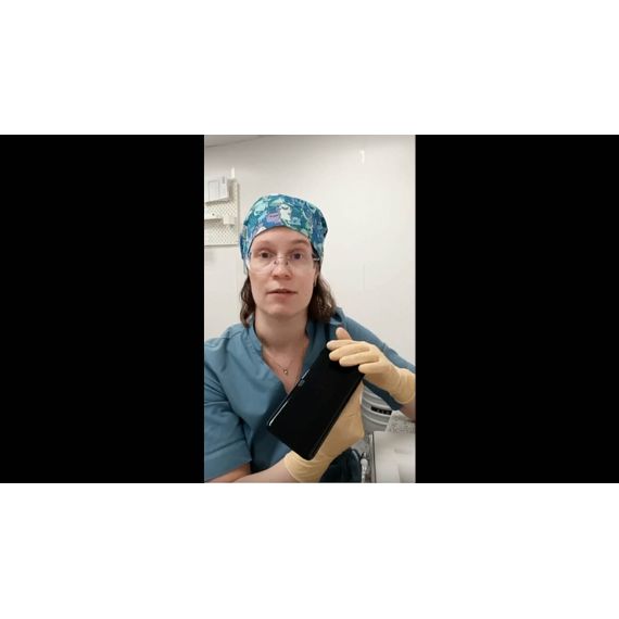 Фундус-камера на апробации у Екатерины Васильевой