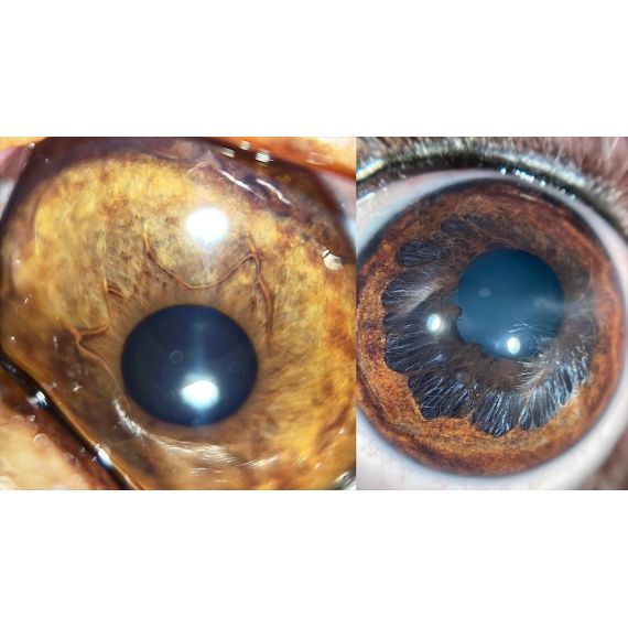 Камер-адаптер QuikVue Plus для съемки переднего отрезка глаза